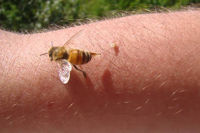 All About Bee Stings